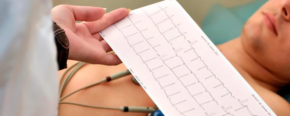 Electrocardiograma a domicilio